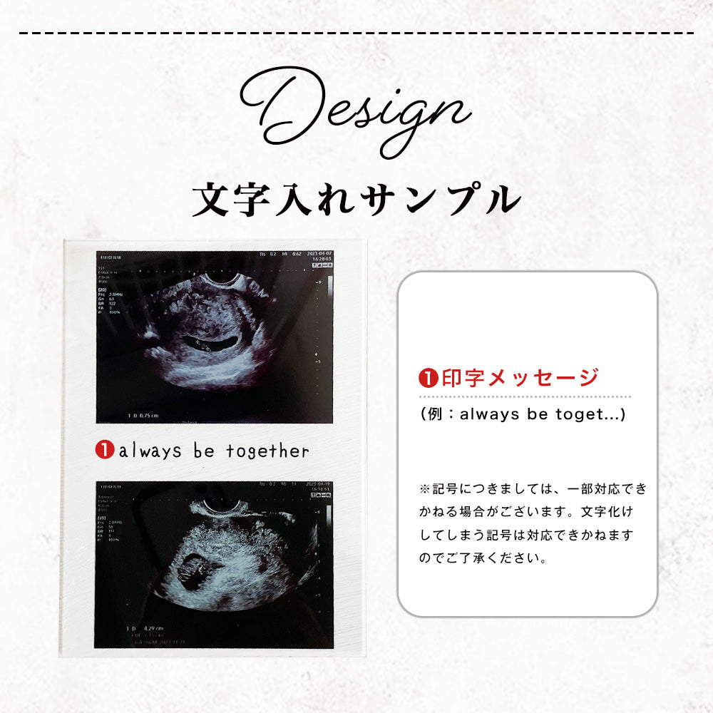 エコー写真 出産 思い出 アクリルパネル #A05-1